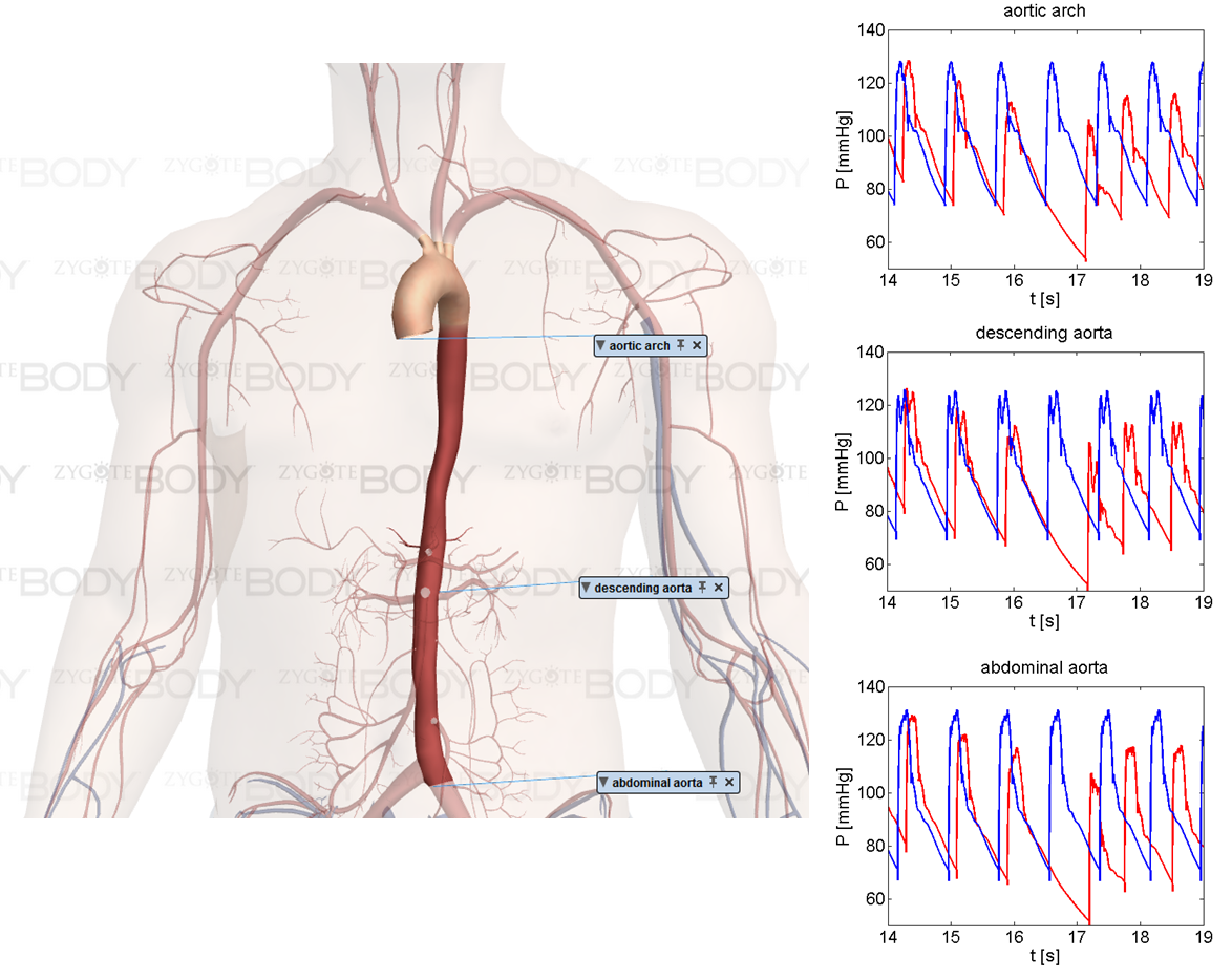 Physio Ex Lab Exercise 5 Cardiovascular Dynamics 1-4